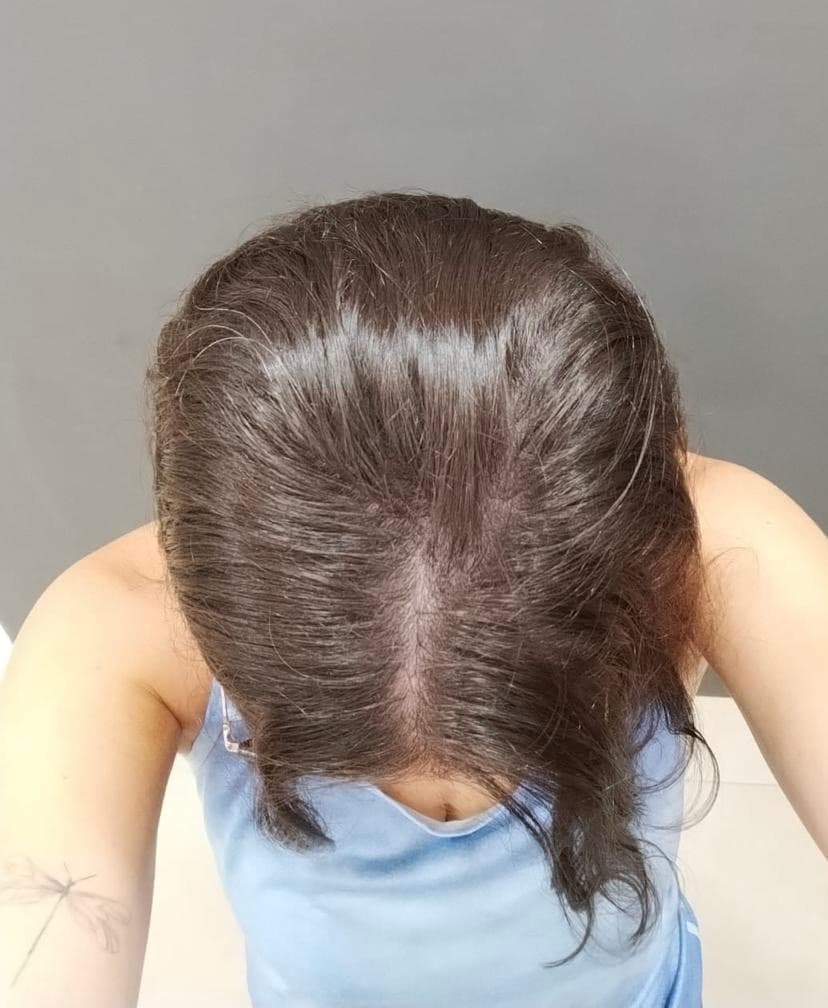 Antes