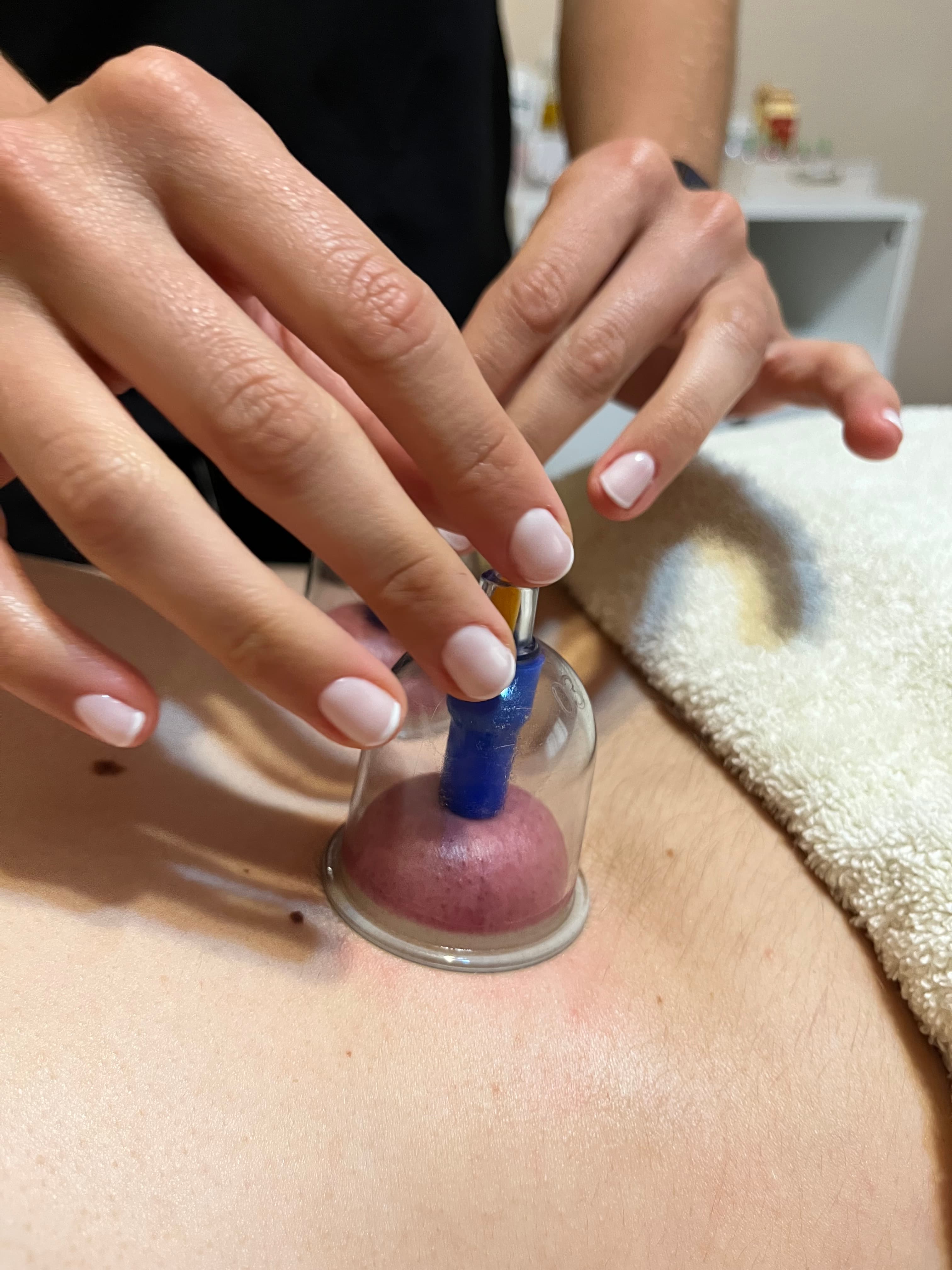 Ventosas